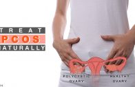 Treat PCOS Naturally | Nutritionist Guide